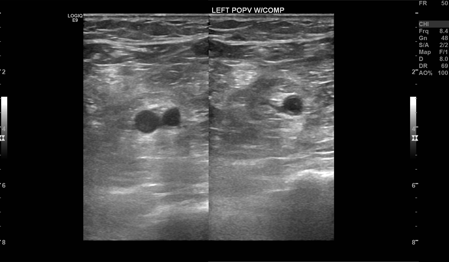 Sonography Vascular And Lymphatic Assessment Protocols And