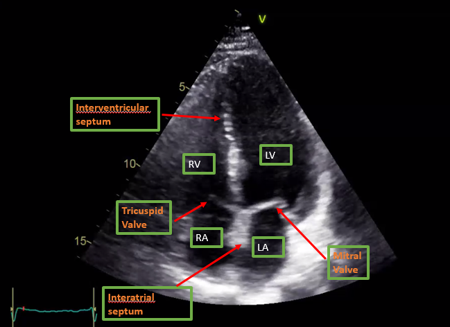 Ultrasound Adult Echocardiography Assessment Protocols And