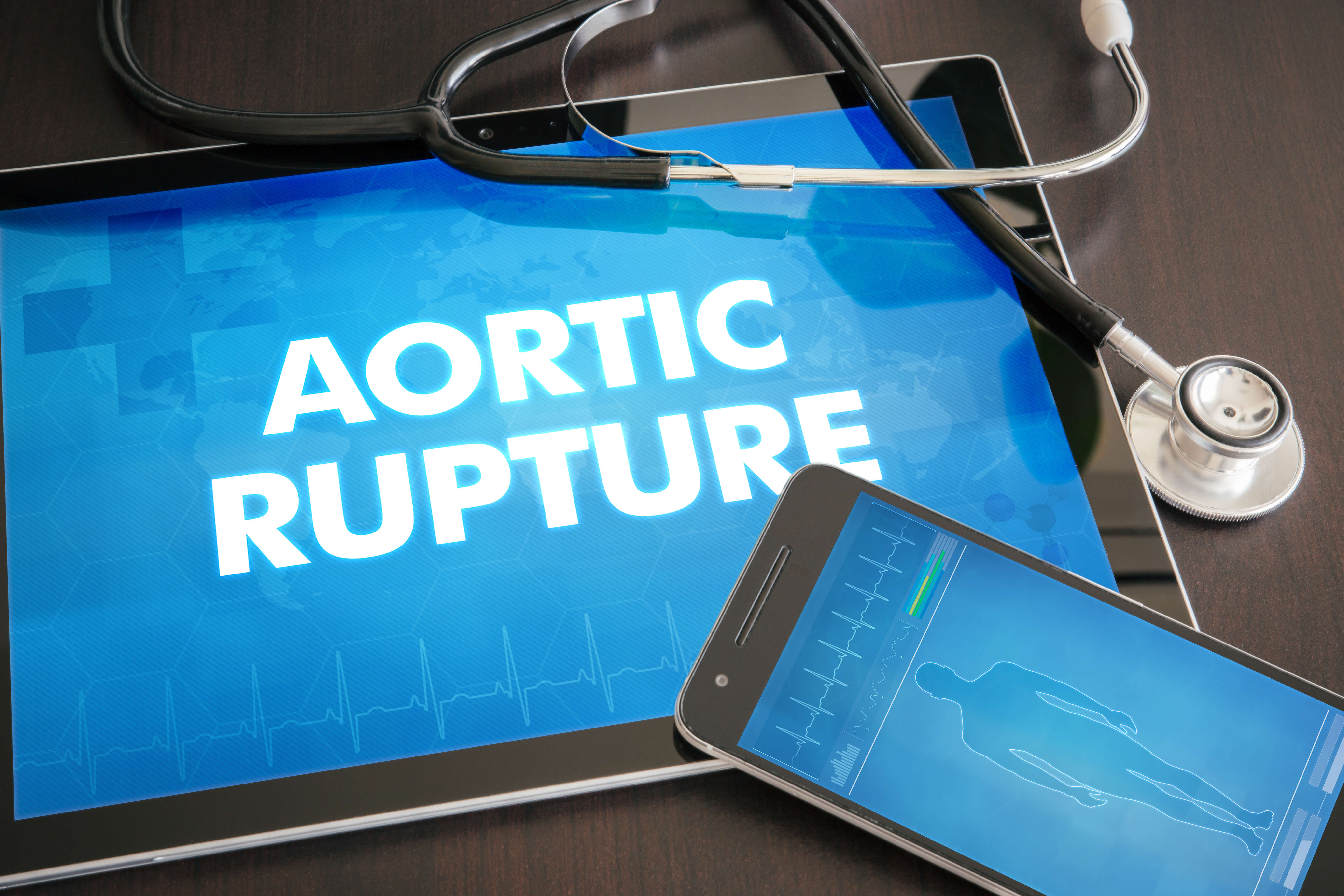 cme-activity-aortic-rupture-mds-pas