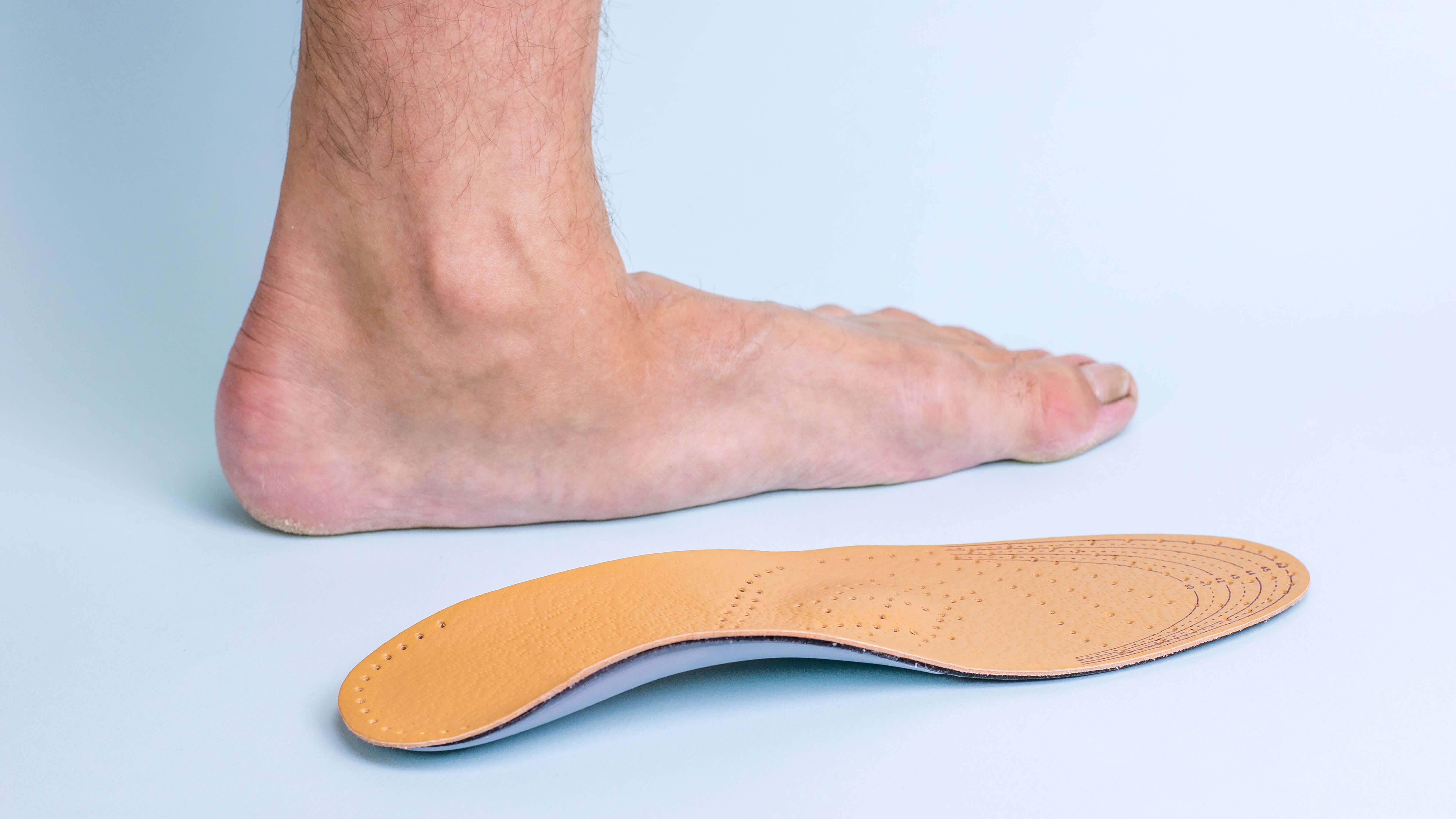 CE Activity Adult Acquired Flatfoot Nurses