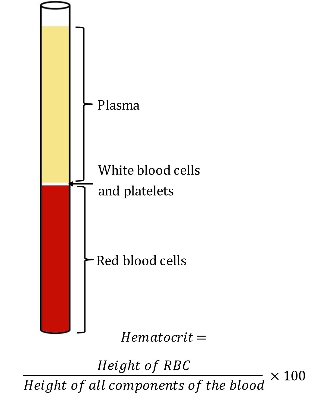<p>Wintrobe Hematocrit Tube Containing Blood Components After Centrifugation</p>