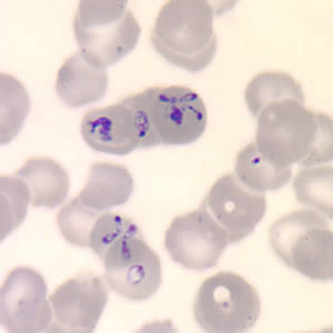 Tetrads, a dividing form characteristic for Babesia.