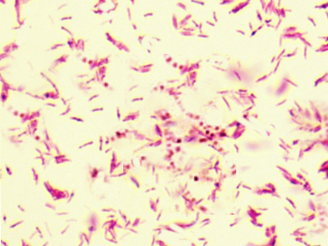 <p><em>Mycobacterium Kansasii</em></p>
