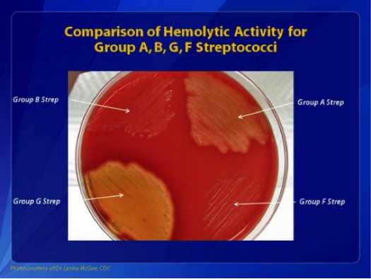Figure 1: Comparisons of hemolytic activity for groups A, B, G, and F Streptococci