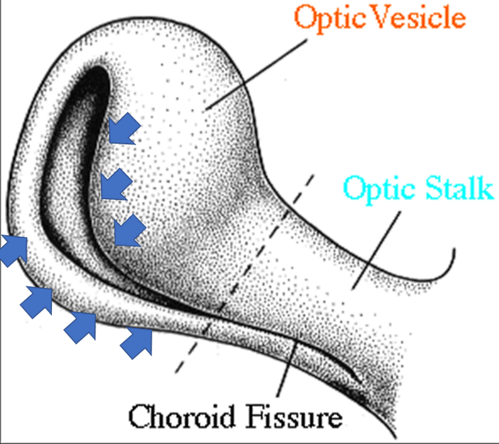 The figure shows the invagination process of the optic stalk and the optic vesicle, with the formation of the choroid fissure (inferiorly)