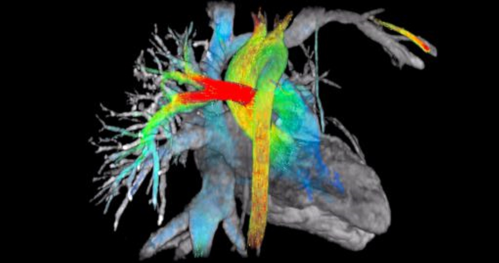 Magnetic resonance imaging can show images of the heart and blood flow.