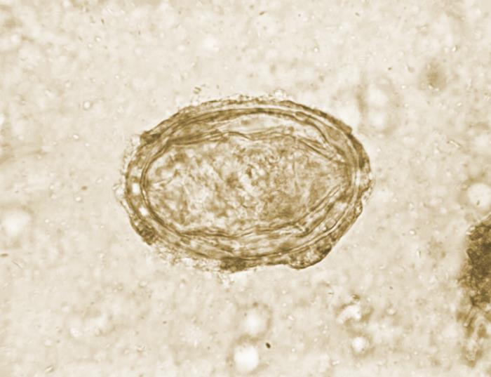 This photomicrograph reveals ultrastructural details exhibited by a single Schistosoma japonicum ovum