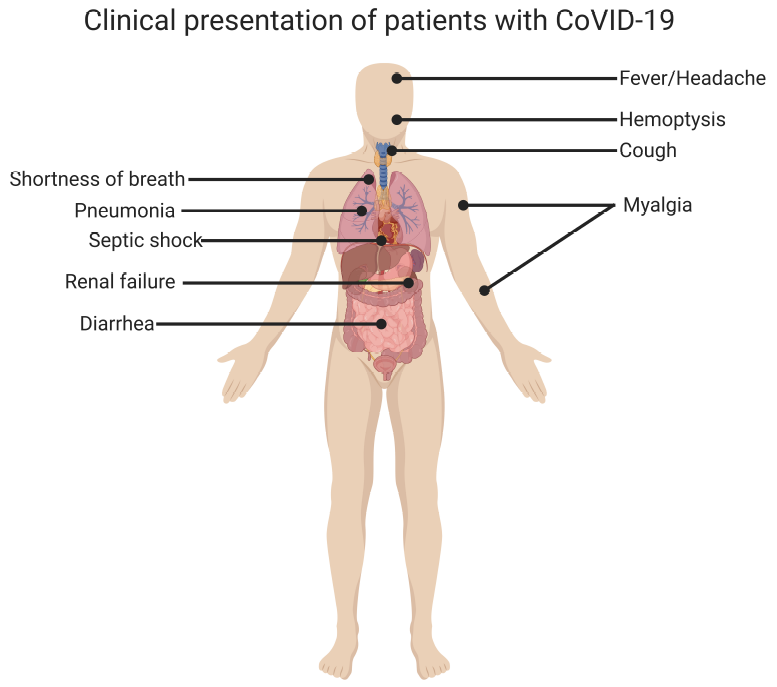 Clinical Presentation of Patients with CoVID-19
