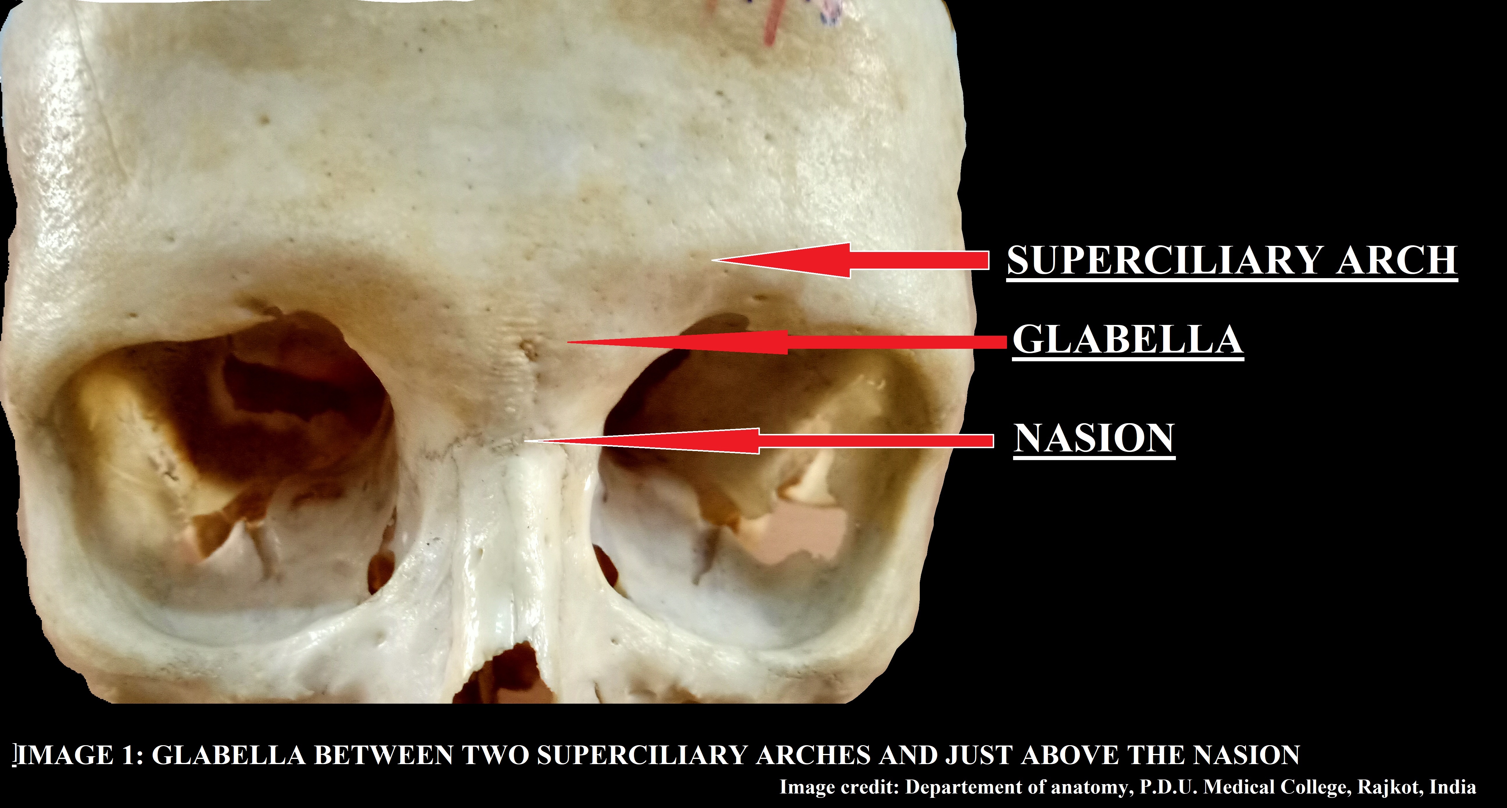 Front of the skull showing Glabella, Superciliary arch and Nasion.