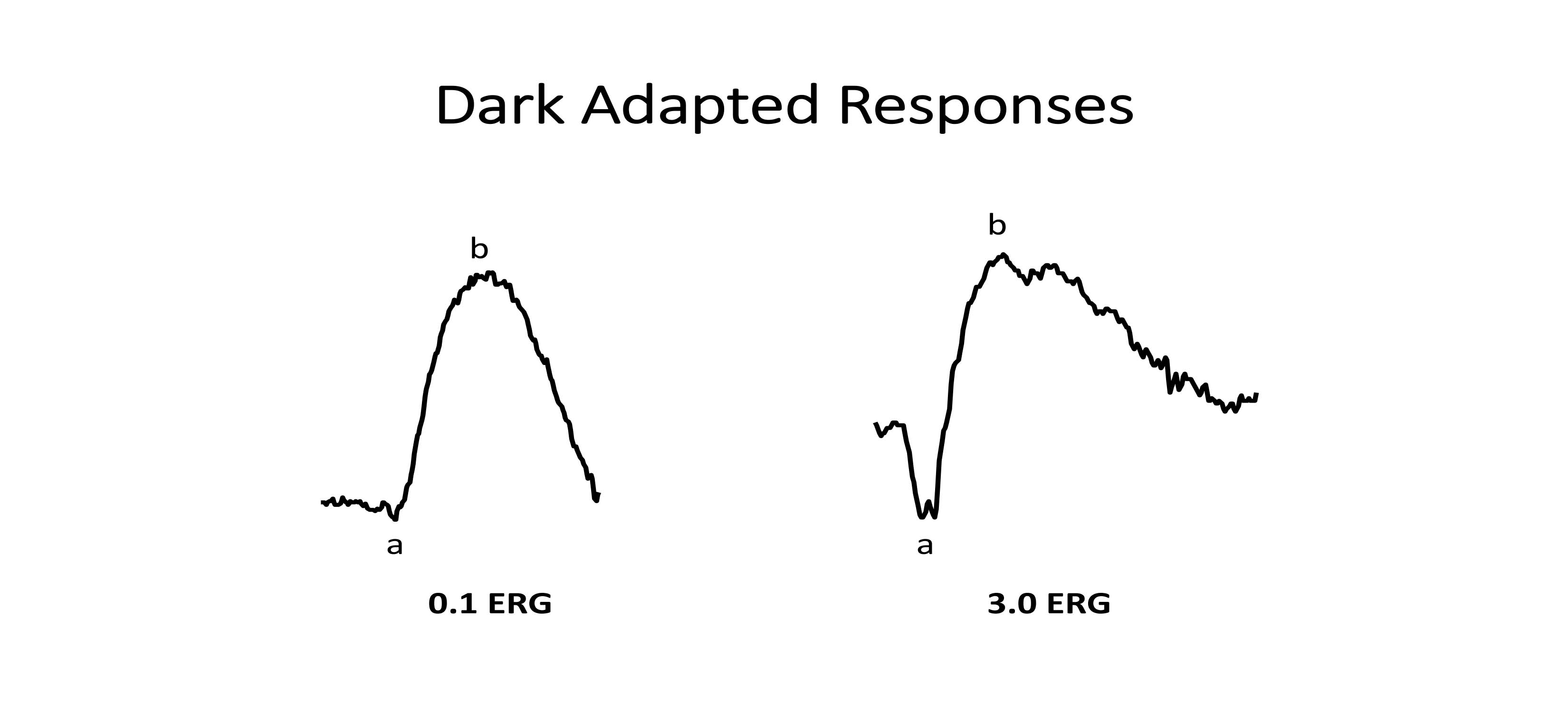 Illustration of a normal the dark adapted ffERG for a low intensity rod response (0