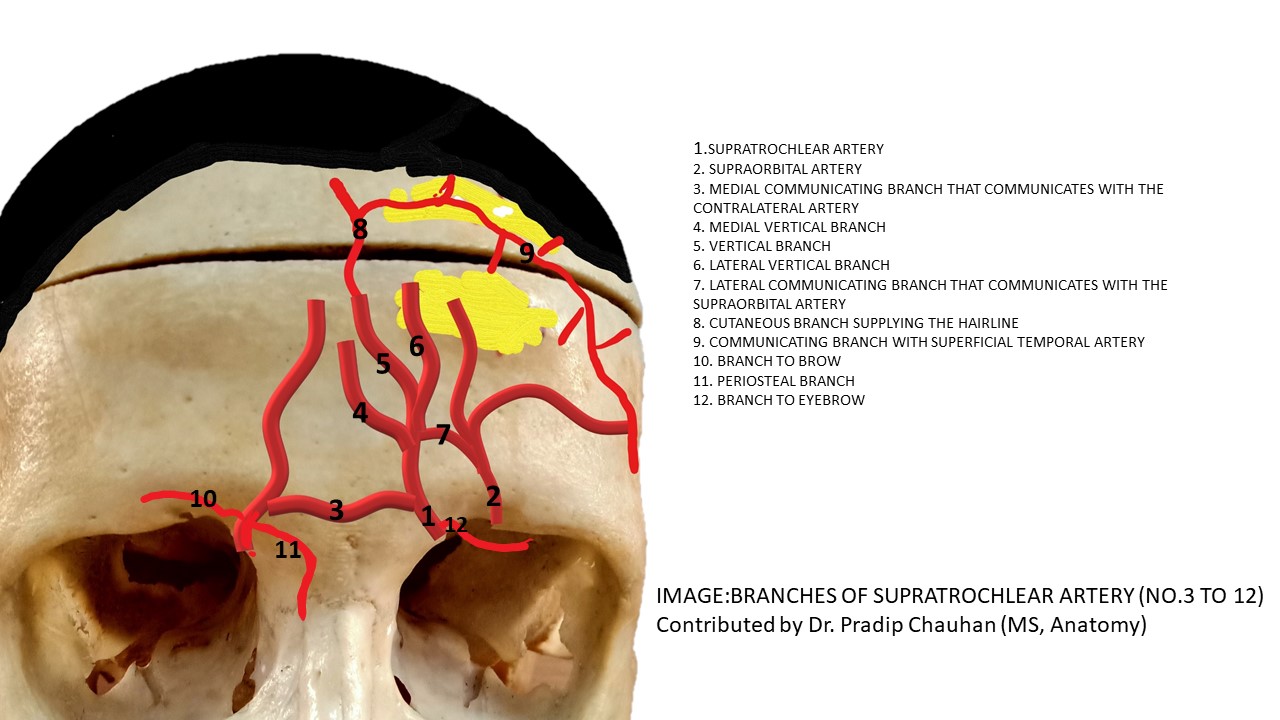 <p>Supratrochlear Artery Branches</p>