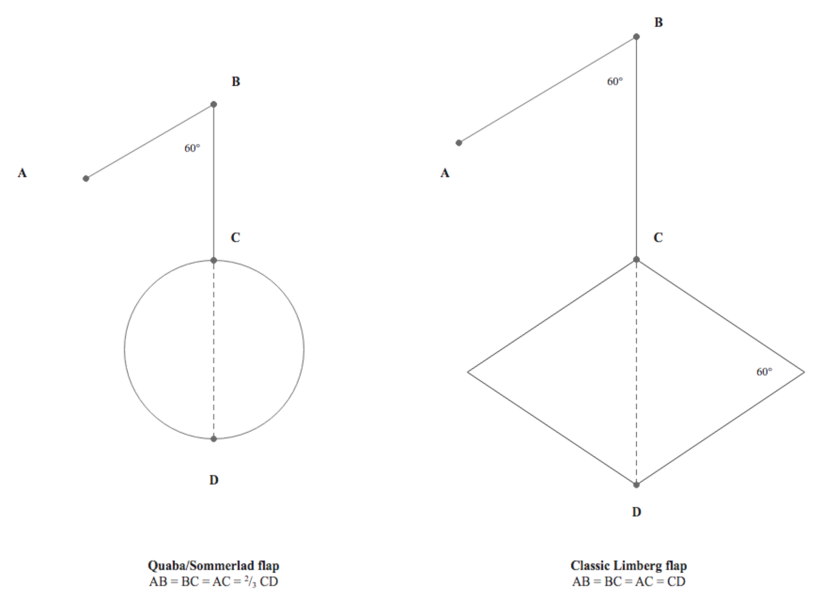 <p>Comparison of Quaba-Sommerlad Modification and Classic Limberg Rhombic Flap Design