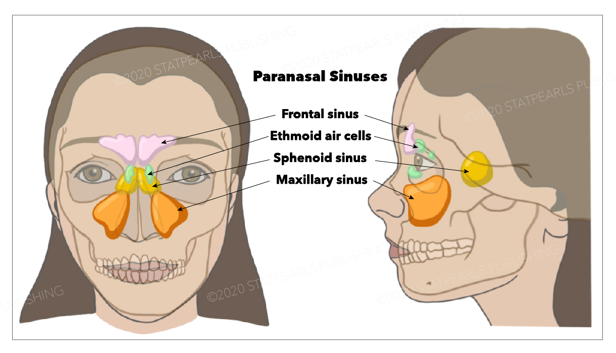 <p>Paranasal Sinuses. This image shows the&nbsp;frontal, sphenoid, and maxillary sinuses and the&nbsp;ethmoid air cells.</p>