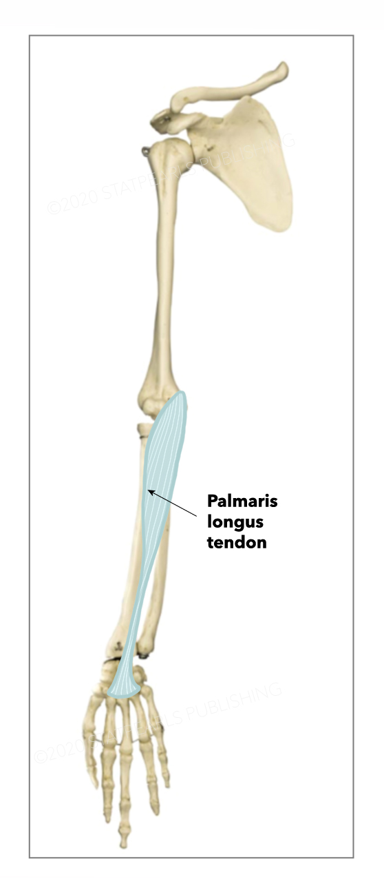 Palmaris longus tendon
