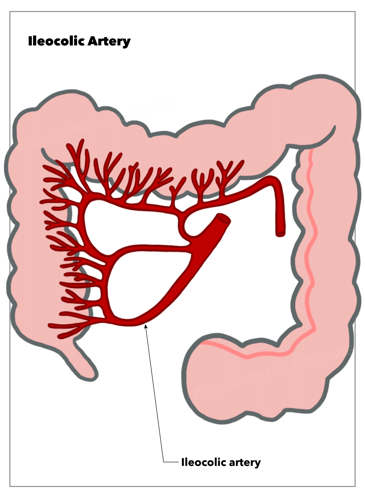 <p>Ileocolic Artery, Intestine</p>