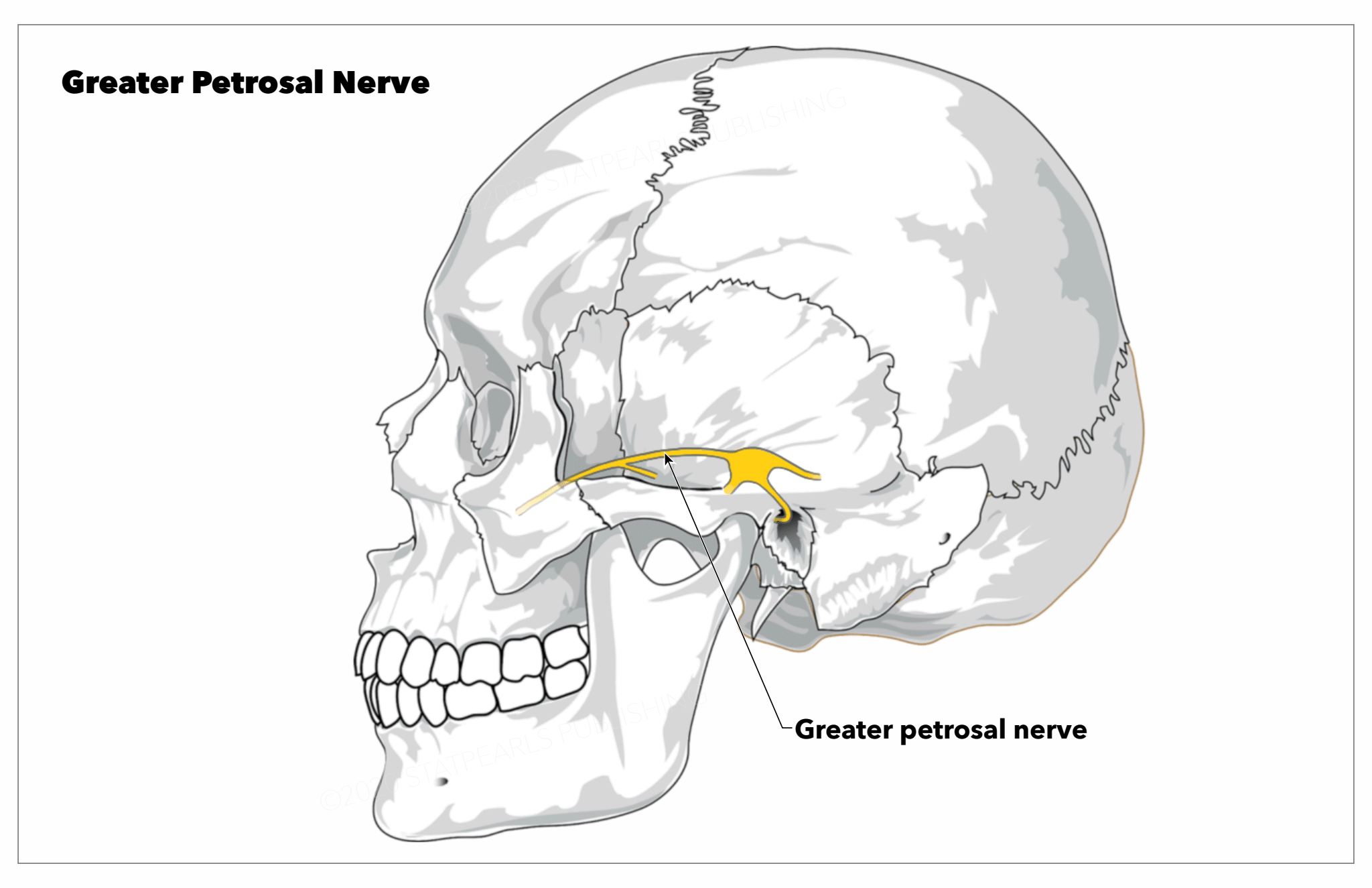 <p>Greater Petrosal Nerve</p>