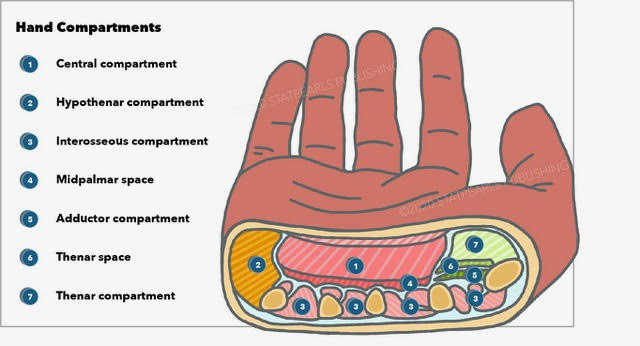 Hand compartments: central compartment, hypothenar compartment, interosseous compartment, midpalmar space, adductor compartme