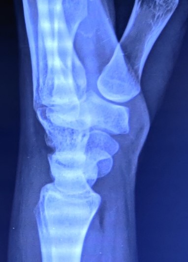 Normal lateral radiograph of the wrist joint showing normal alignment of the carpal bones.