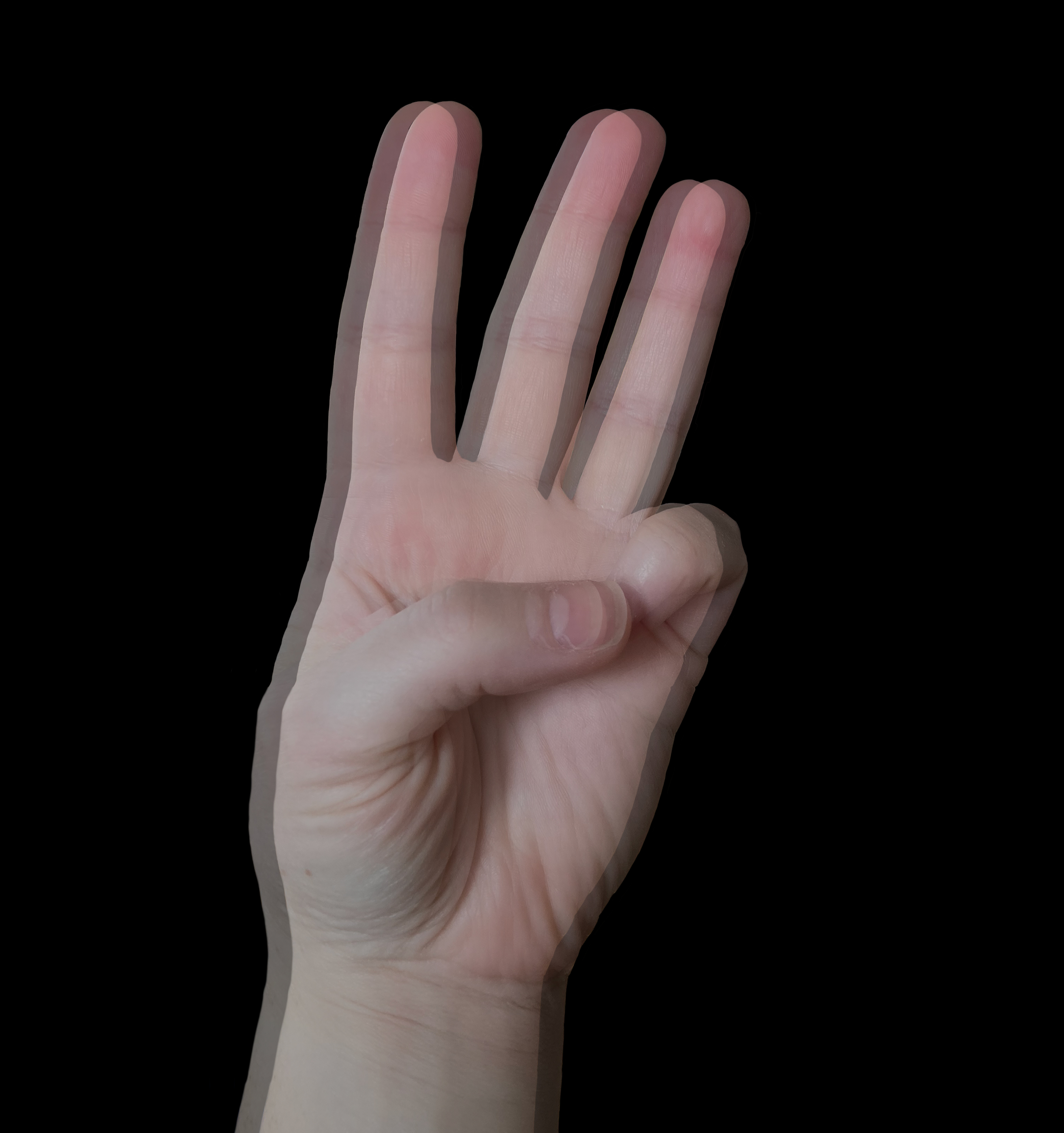 Diplopia. Image of blurred hand illustrating double vision.