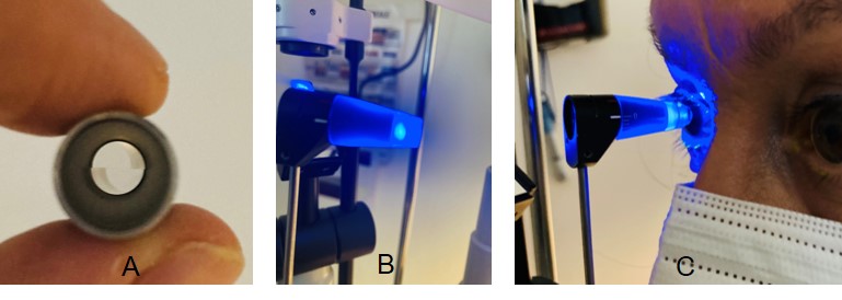 A tip with a split-image prism (A) is used with the Goldmann Applanation Tonometer (GAT), which is mounted on a slit-lamp (B)