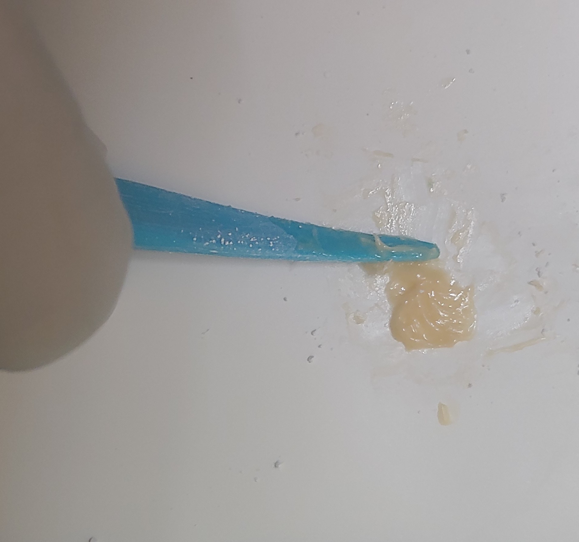 <p>Freshly Mixed Glass Ionomer Cement