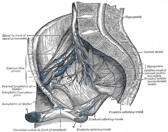 <p>Lymphatics of the abdomen and pelvis, External and Internal iliac lymph nodes, Perirectal lymph nodes</p>