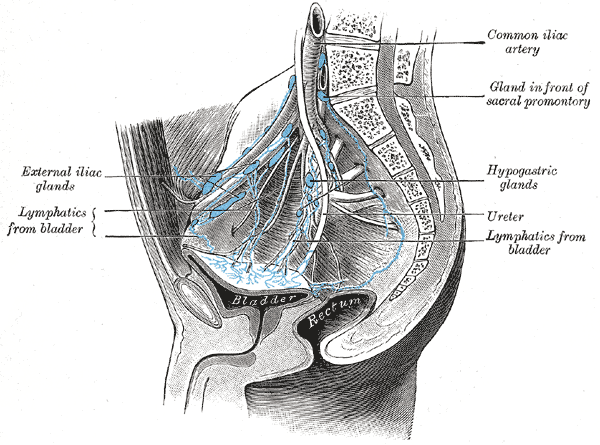 <p>iliac chain lymph nodes, Lymph gland in front of sacral promontory, Hypogastric lymph glands, Lymphatics from bladder</p>