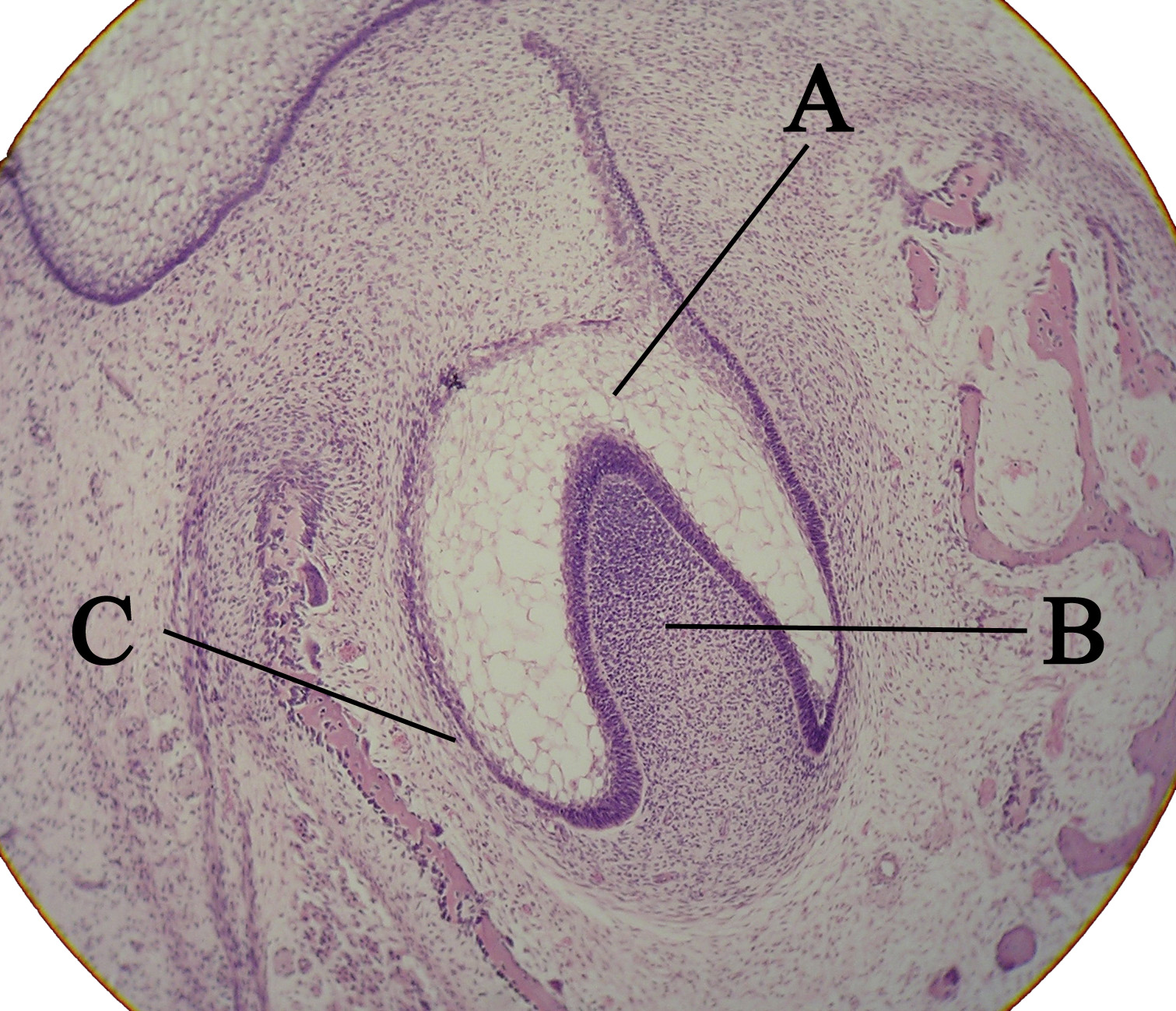 <p>Microscopic View of a Tooth Bud. Labeled areas include: A) enamel organ. B) dental papilla. C) dental follicle.</p>