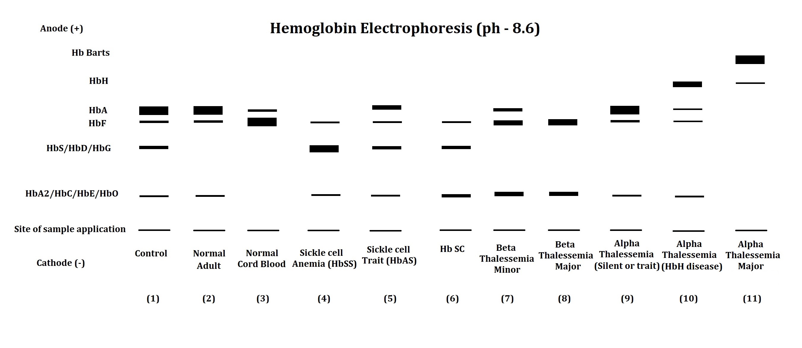 <p>Hemoglobin Electrophoresis Patterns of Hemoglobin Disorders