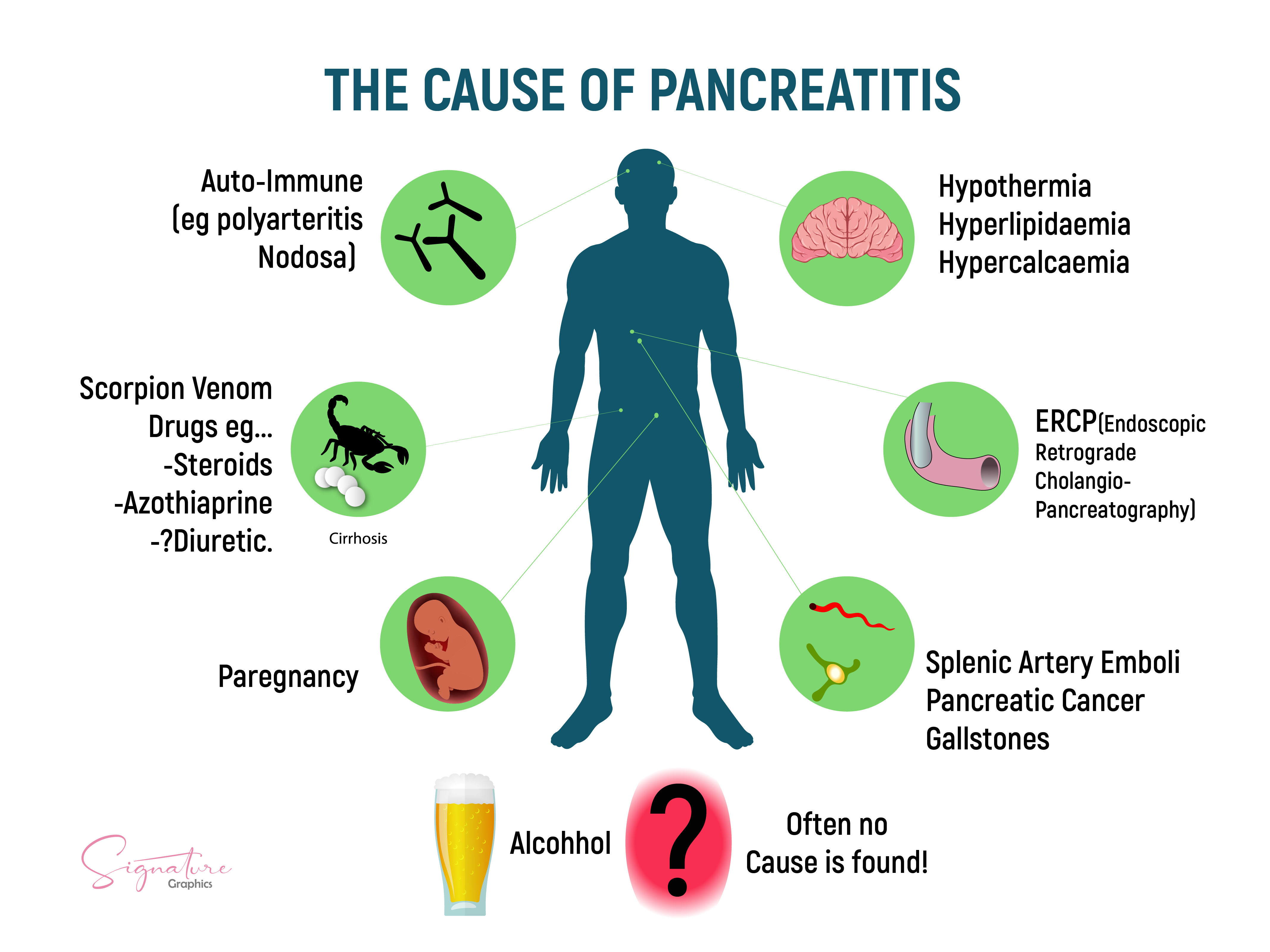 This is a graphic illustration of the causes of acute pancreatitis.