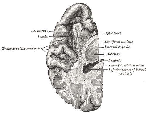 <p>Section of brain showing upper surface of temporal lobe, Claustrum, Insula, Transverse temporal gyri, Optic tract, Lentifo