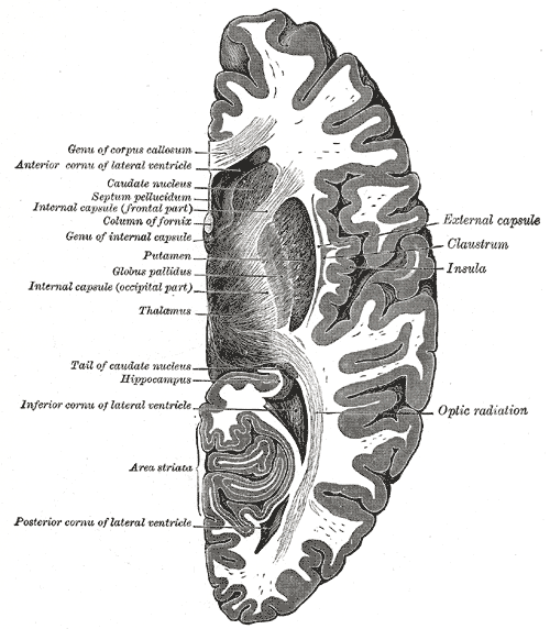 <p>Horizontal section of right cerebral hemisphere, Genu of Corpus callosum, Anterior cornua of lateral ventricle, Caudate nu