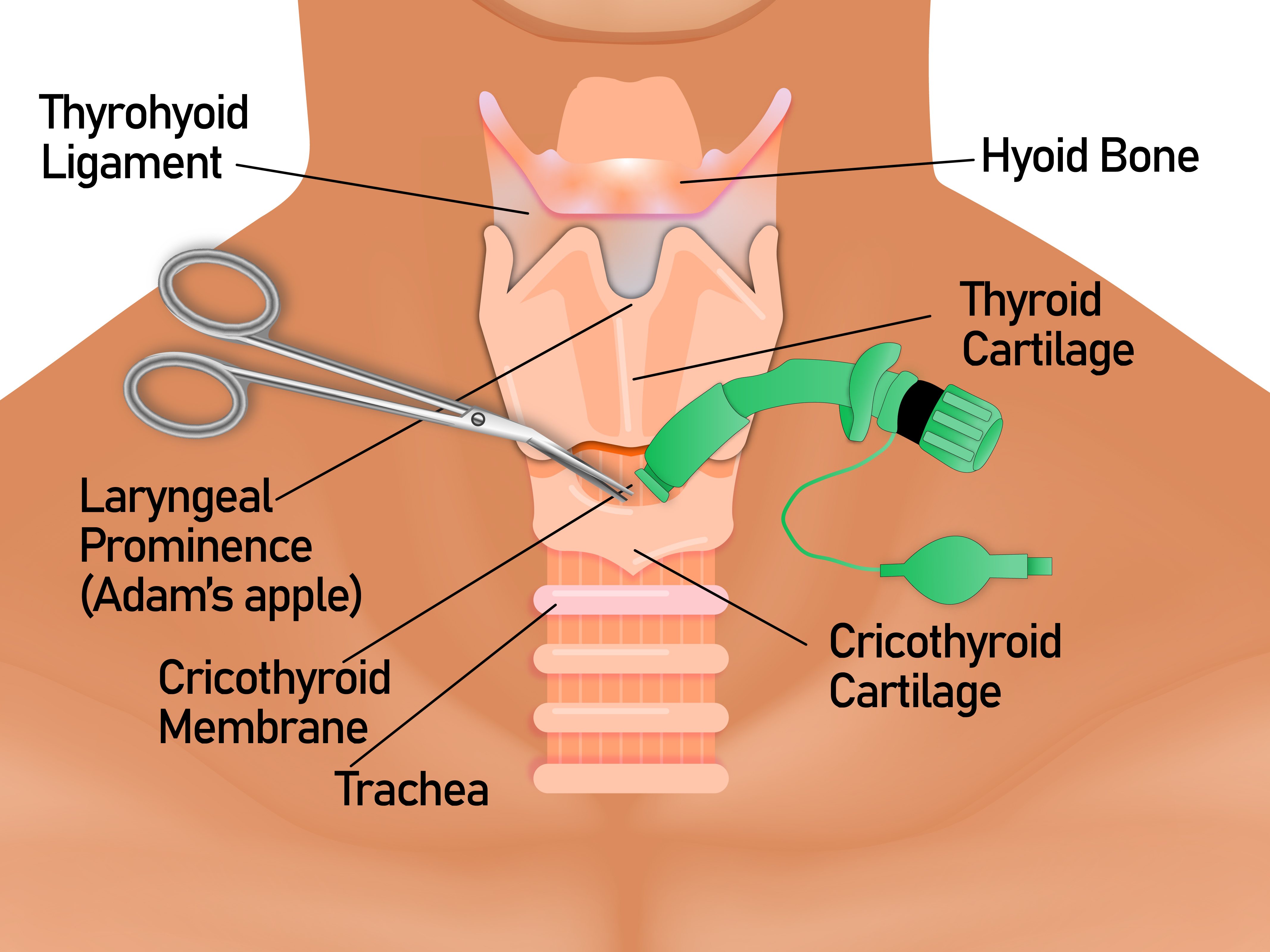 This image illustrates the anatomy and the framework of airway in the neck region