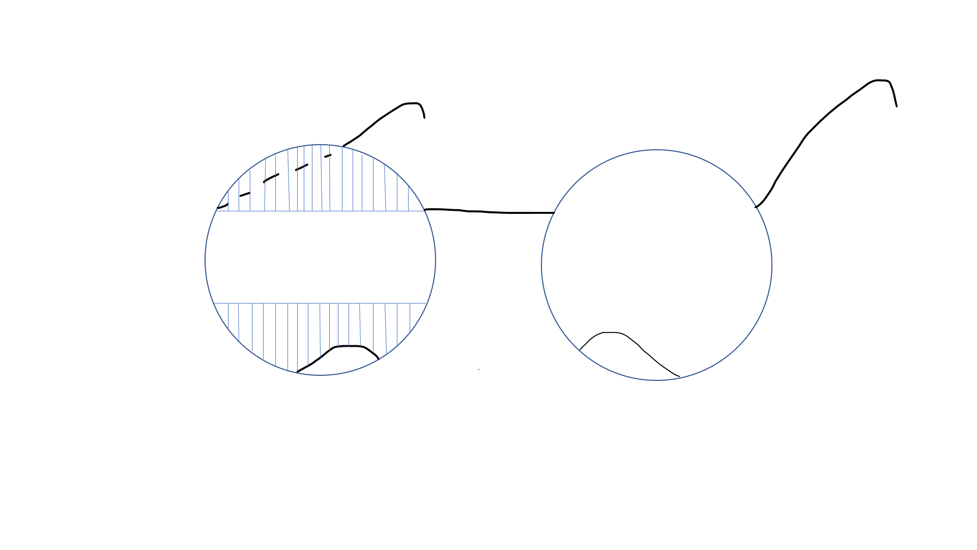 Peli prisms for right homonymous hemianopia (schematic diagram, for users of bifocal lenses)