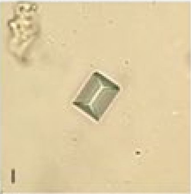 <p>Triple Phosphate Crystals