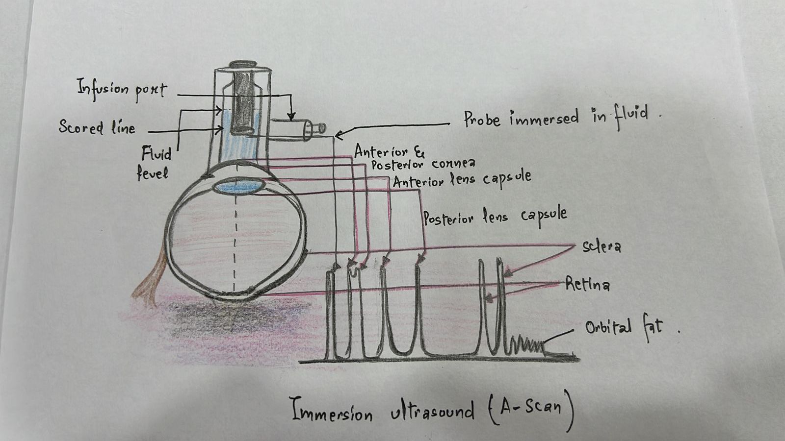 <p>Ultrasound Biometry Schematic Diagram