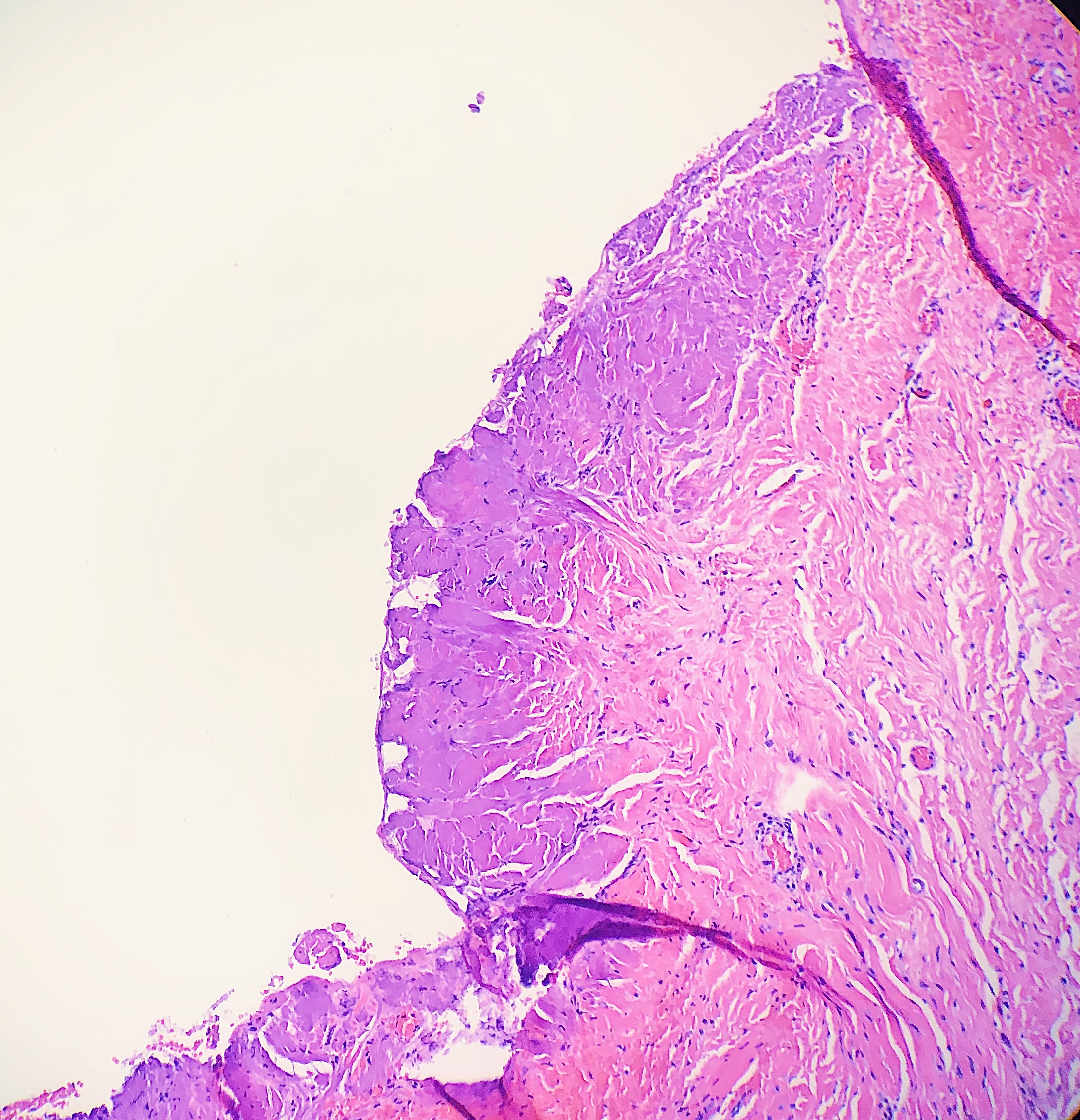 <p>Histology Collagen Folds