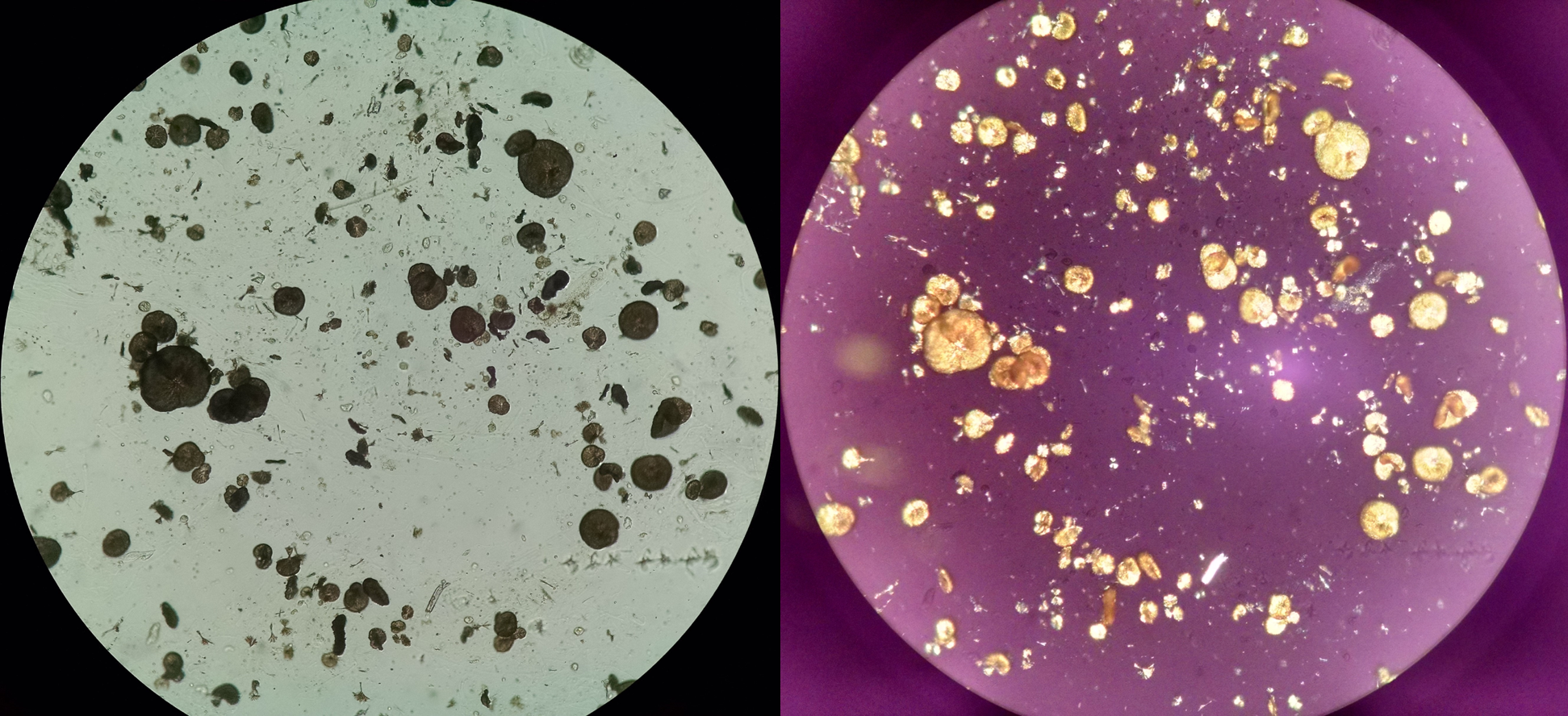 <p>Sulfadiazine Crystals