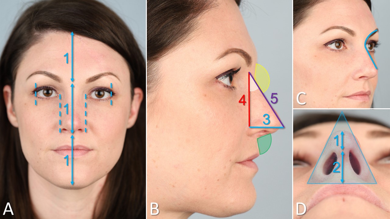 <p>Nasal Analysis