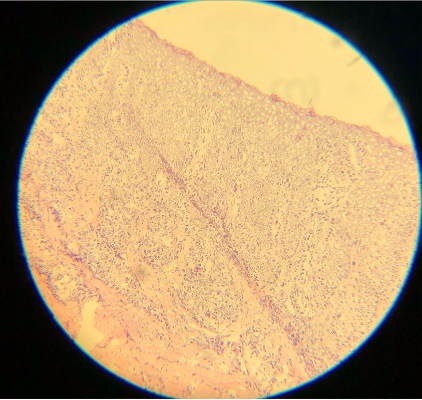 <p>Thin Section B