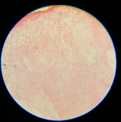 <p>Skipped Hematoxylin B.&nbsp;Slides are virtually uninterpretable when staining with hematoxylin staining is skipped.</p>