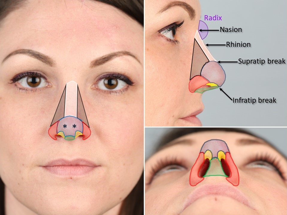 <p>External Nasal Anatomy