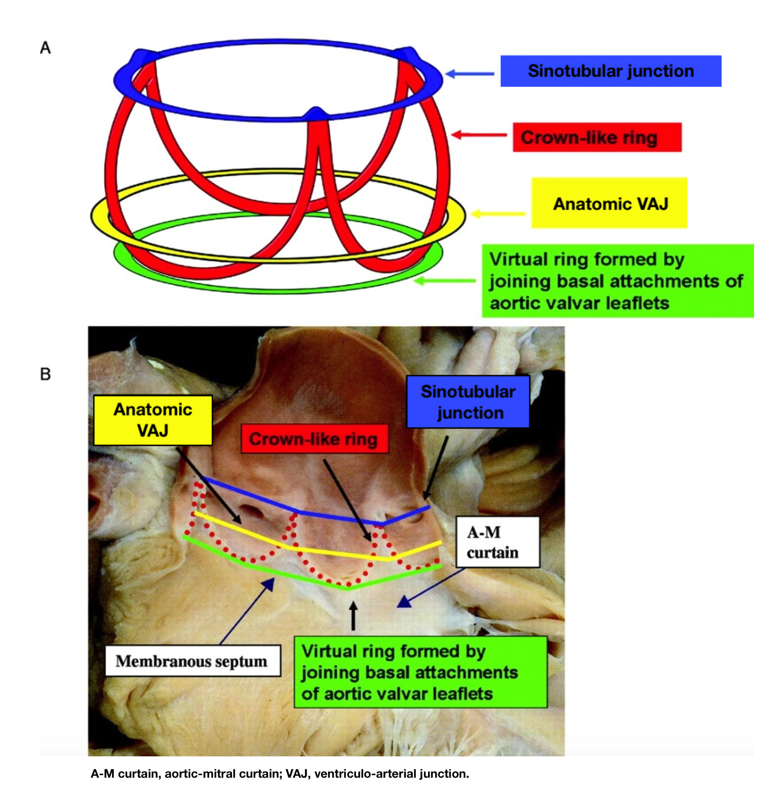 <p>The Anatomy of the Aortic Valve</p>