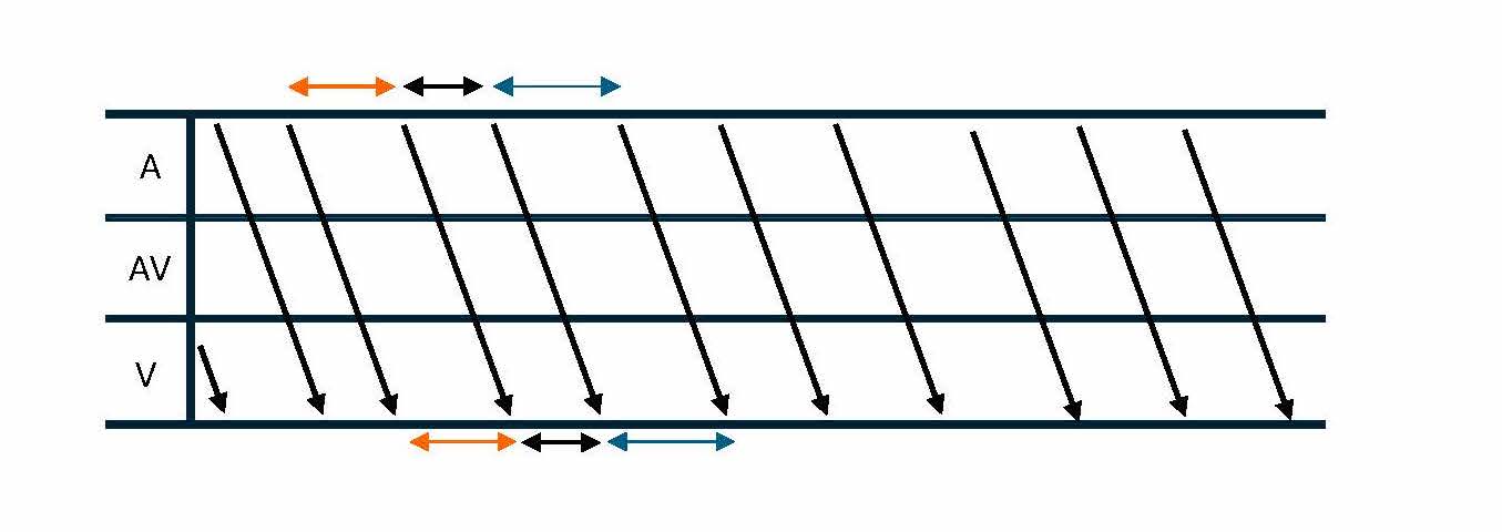 <p>Ladder Diagram of Atrial Tachycardia Cycle Length Variability