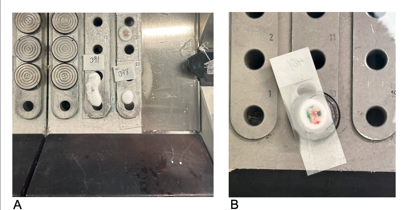 <p>Freezing Tissue in the Cryostat Machine