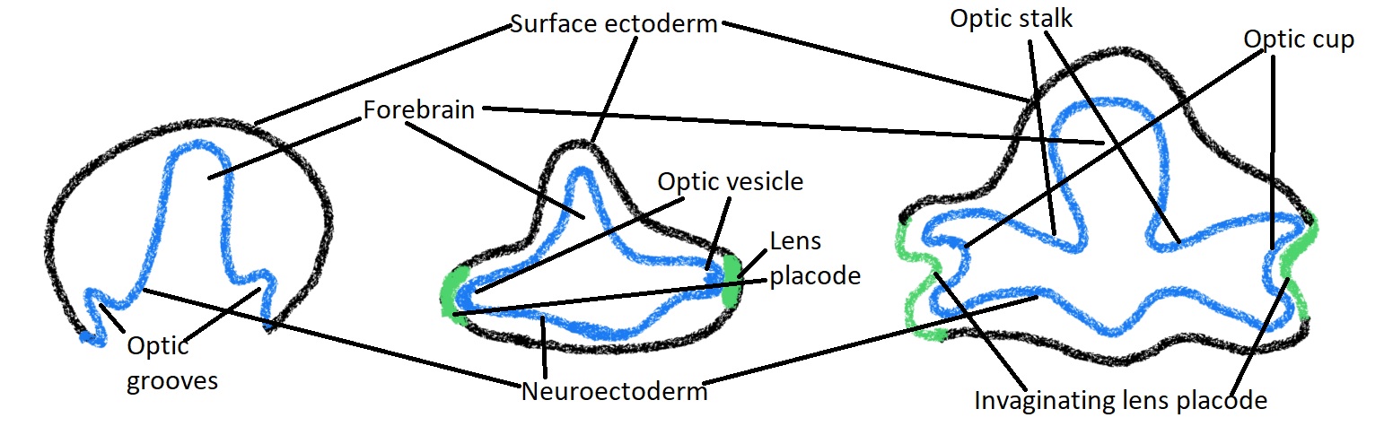 <p>Embryological Development of Optic Vesicle. This diagram depicts the optic vessel's 3 main developmental stages.</p>