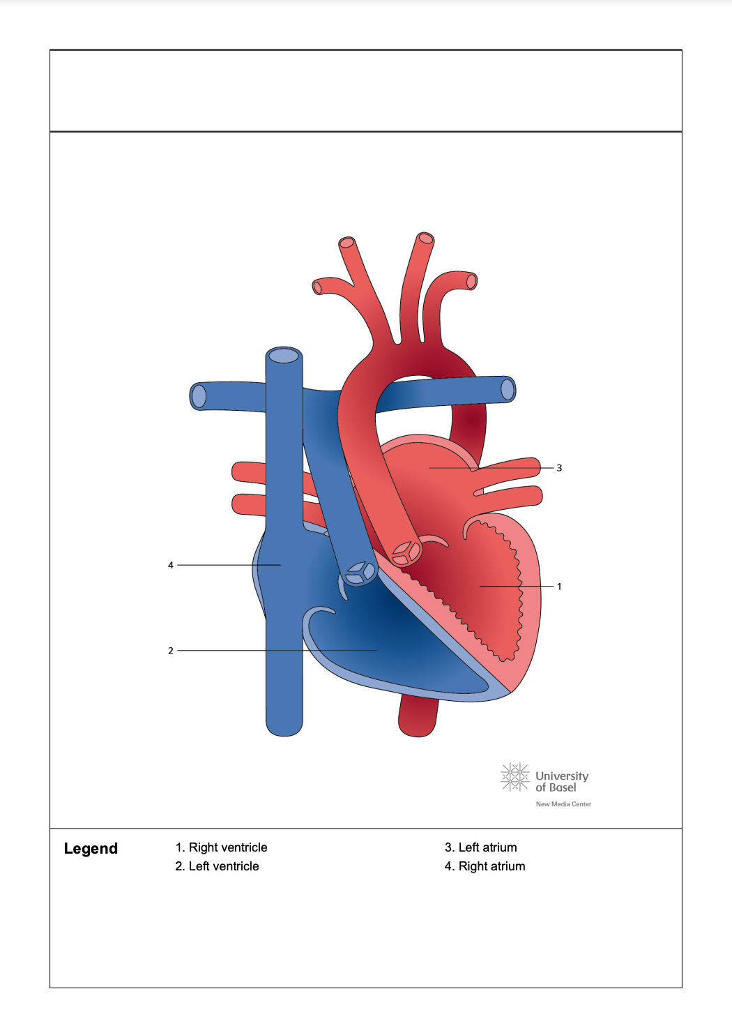 <p>Congenitally Corrected Transposition of the Great Arteries