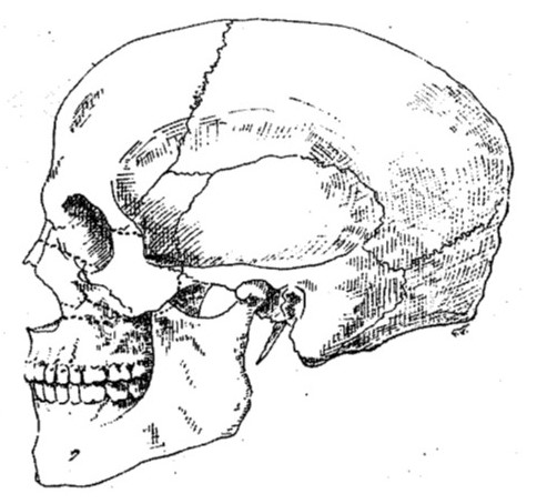 <p>Facial Great Lines of Weakness, Profile View