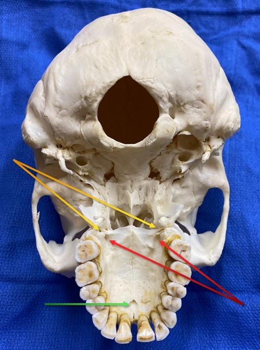 <p>Foramina of the Palate, Inferior View