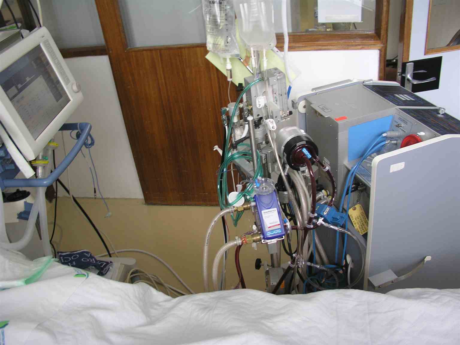 <p>ECMO Machine for a Patient in the Intensive Care Unit